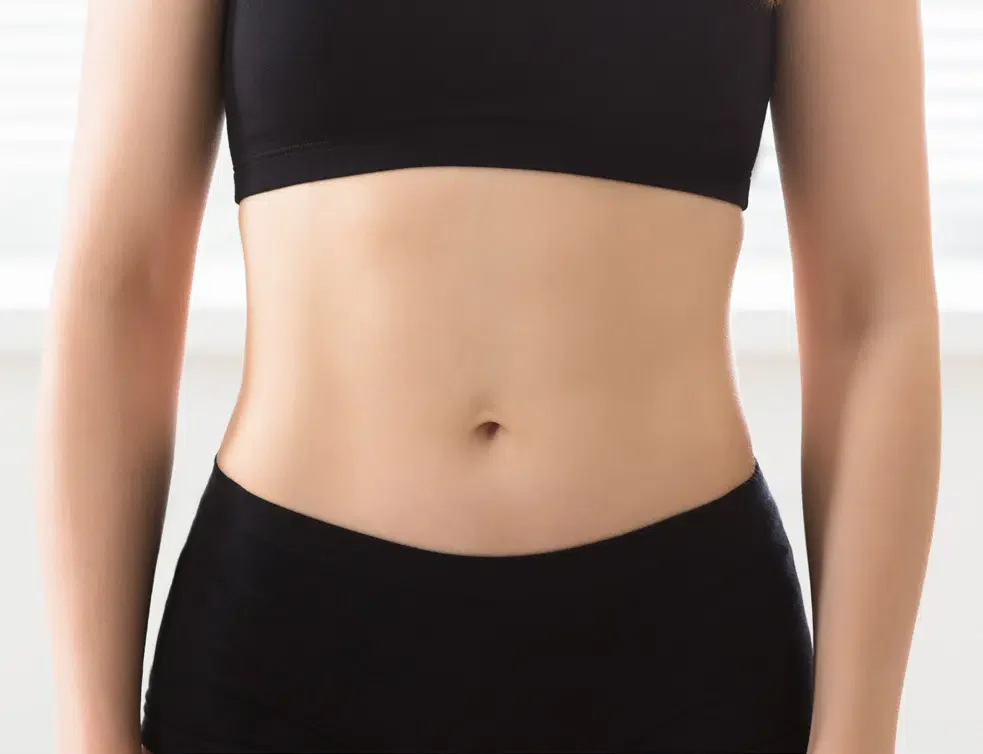 BodyTone female patient after treatment