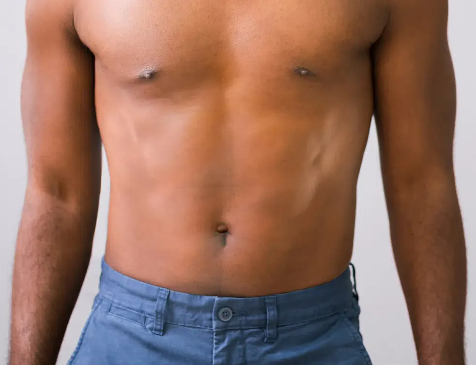 BodyTone male patient after treatment