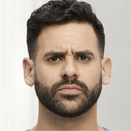 Male Botox patient before treatment, result 1