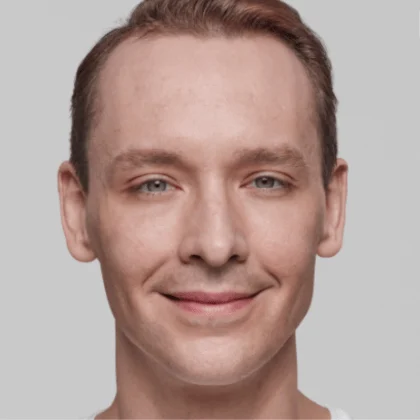 Male Restylane patient after treatment, result 2