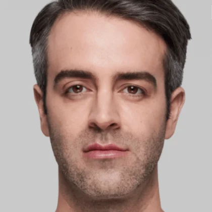 Male Restylane patient after treatment, result 1