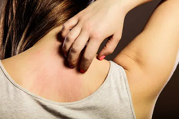 Common rash types and skin symptoms